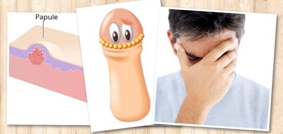 จู๋มีสิว อาการนี้ถือว่าเราผิดปกติหรือไม่? มาดูคำตอบกัน