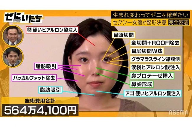 สาวเอวี Yuko Koga ลงทุนกับการทำศัลยากรรมทั้งตัวไป 6 ล้านเยน